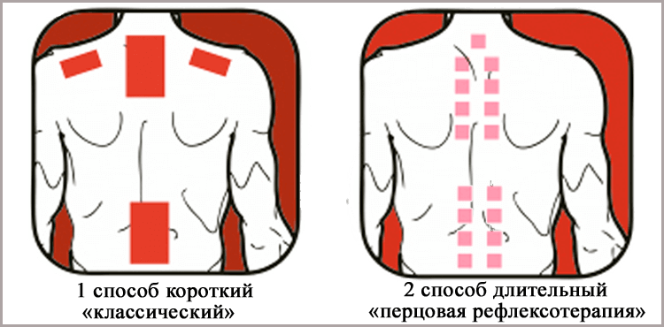 Обезболивающие пластыри при болях в спине и суставах: какой лучше .