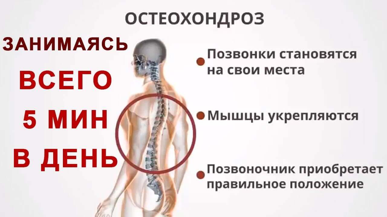 Клиническая картина метастатического поражения позвоночника отличается от остеохондроза