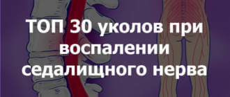 воспаление седалищного нерва, ишиас, уколы, инъекции