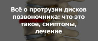 Всё о протрузии дисков позвоночника: что это такое, симптомы, лечения