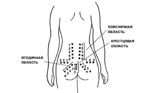 точечный массаж при остеохондрозе поясничного отдела позвоночника